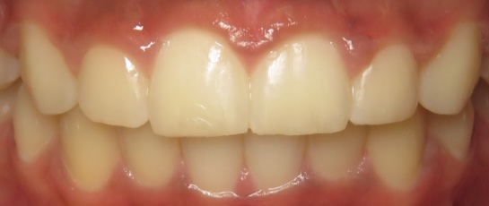 after image