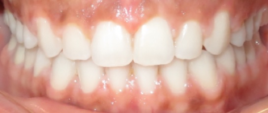 after image