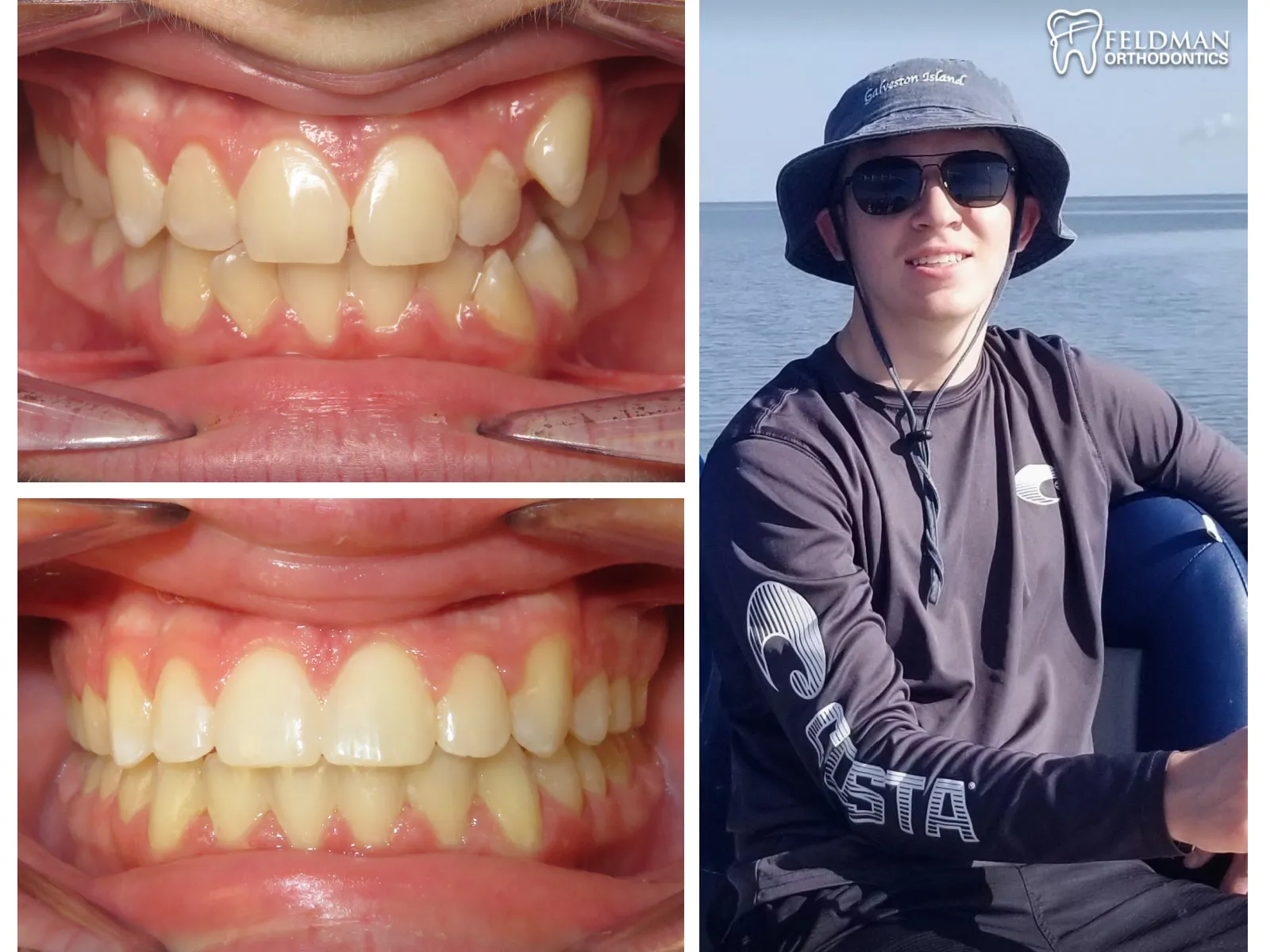 Braden Broussard collage