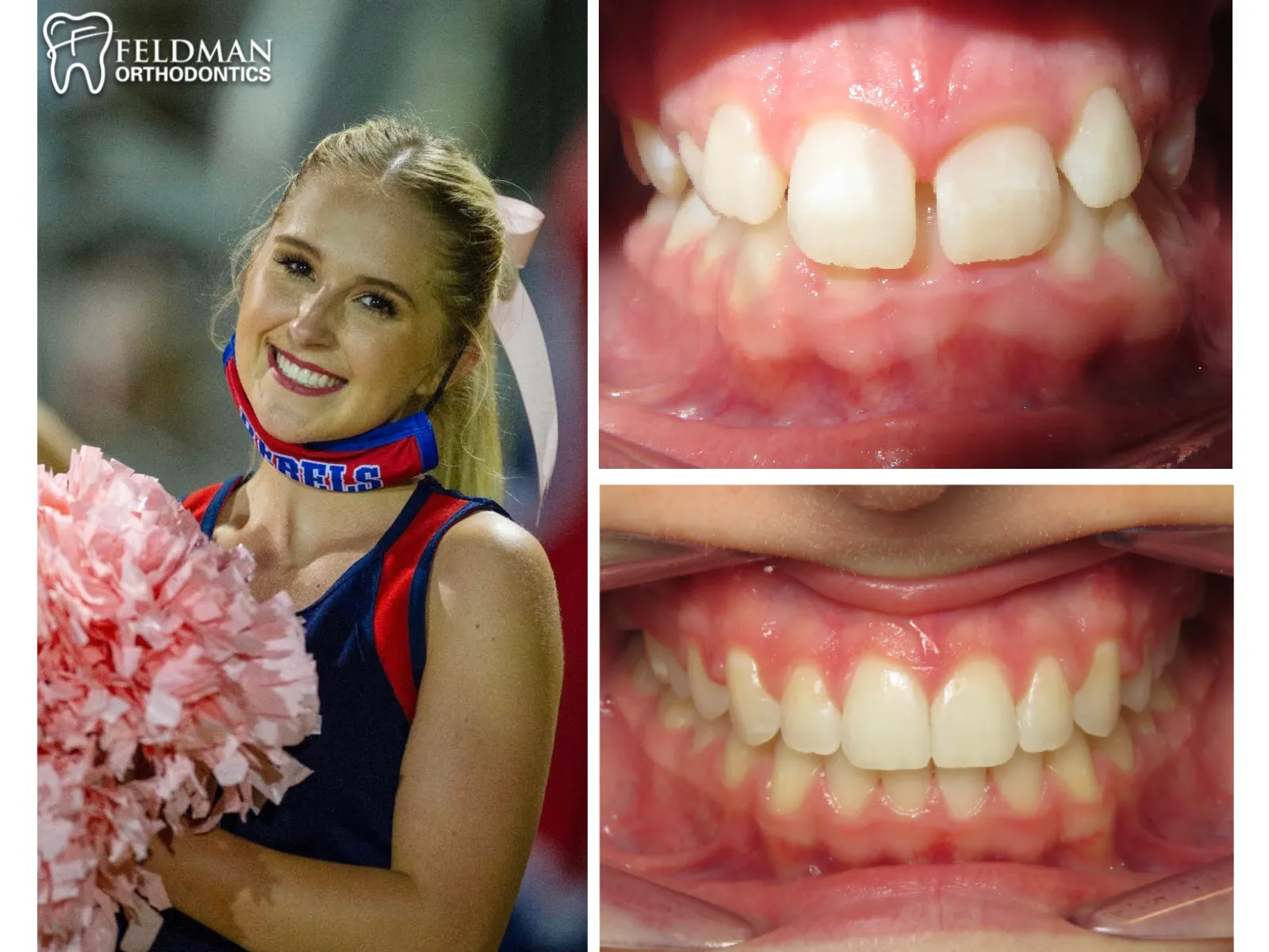 Gracie Latoilais collage