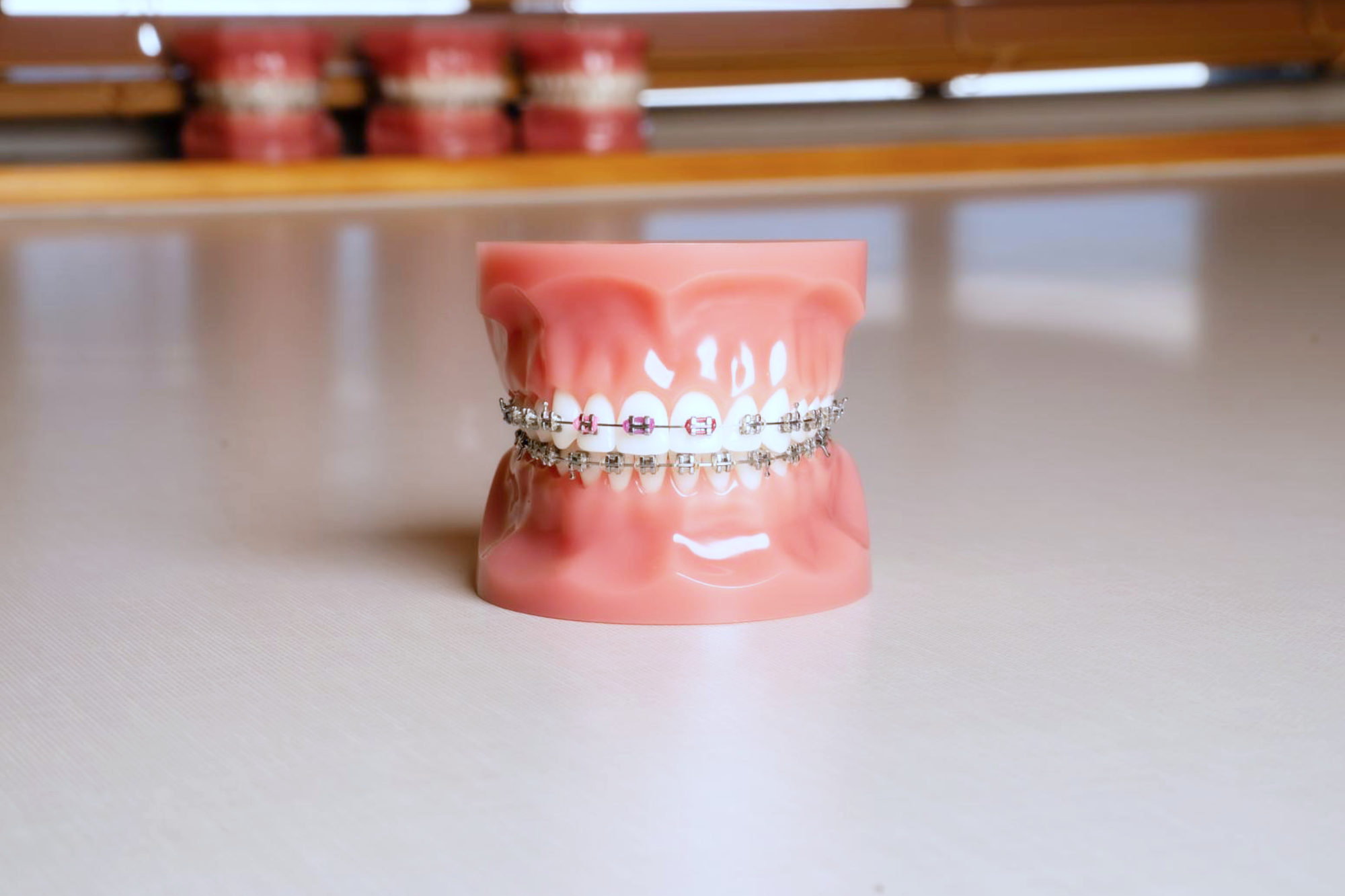 Metal Braces